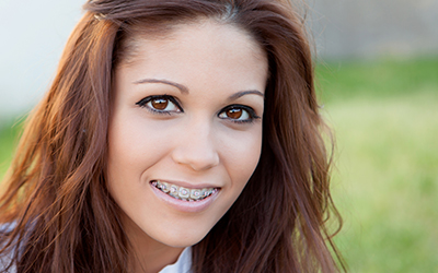 Girl with braces