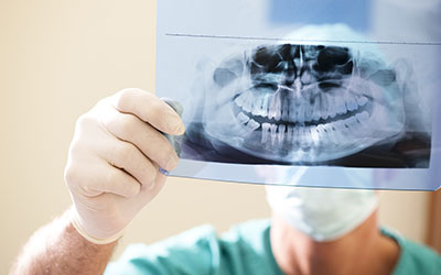 Dental handing looking at dental x-ray