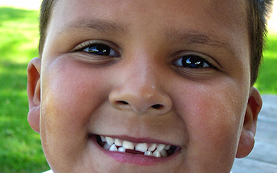 a young boy smiling with missing teeth