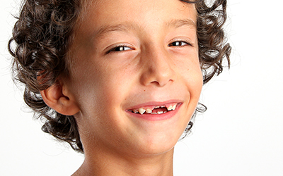 Temporary teeth fall out