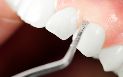 Up-close examination of gums